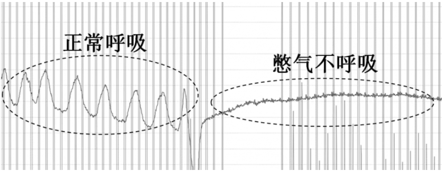 BCG传感器