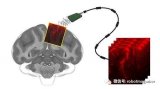新超声波成像技术,可用来大脑控制假肢的新方法