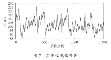 电源