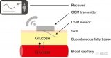 Memtronom的创新CGM技术可以加快<b>糖尿病</b>数字化管理