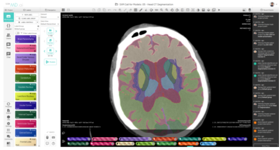 User interface of MD.ai displaying outputs from a brain segmentation model deployed on the platform.