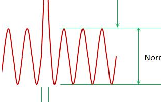 EMC浪涌保護電路的原理和設計