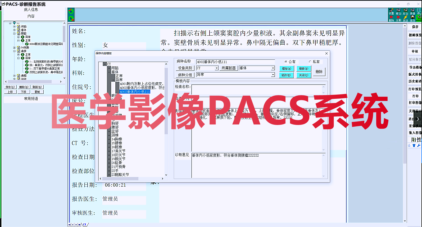 基于C++開發的醫院醫學影像PACS  二次開發，三維重建